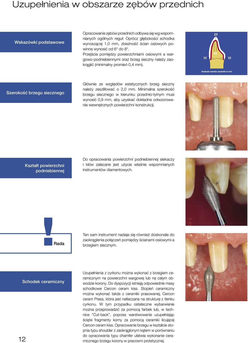 Przejścia pomiędzy powierzchniami osiowymi a wargowo-podniebiennymi oraz brzeg sieczny należy zaokrąglić (minimalny promień 0,4 mm).