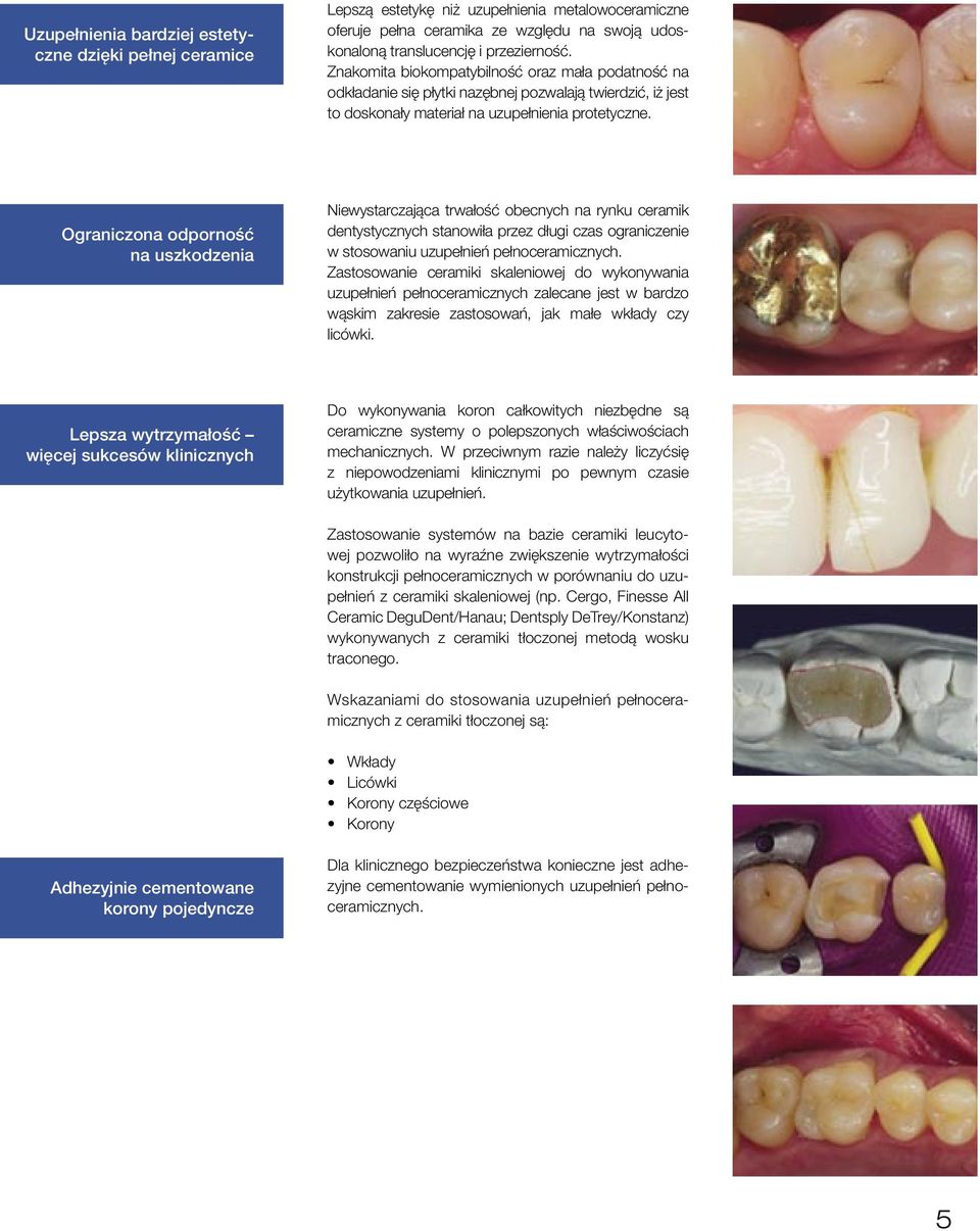Ograniczona odporność na uszkodzenia Niewystarczająca trwałość obecnych na rynku ceramik dentystycznych stanowiła przez długi czas ograniczenie w stosowaniu uzupełnień pełnoceramicznych.
