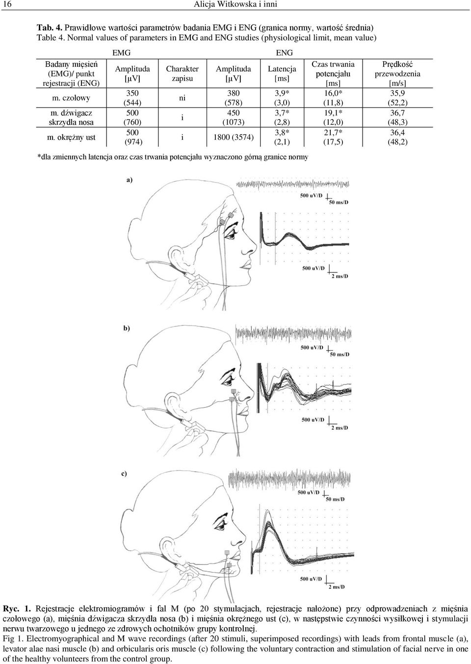 okrężny ust EMG Amplituda [µv] 350 (544) 500 (760) 500 (974) Charakter zapisu ni i Amplituda [µv] 380 (578) 450 (1073) i 1800 (3574) ENG Latencja [ms] 3,9* (3,0) 3,7* (2,8) 3,8* (2,1) *dla zmiennych