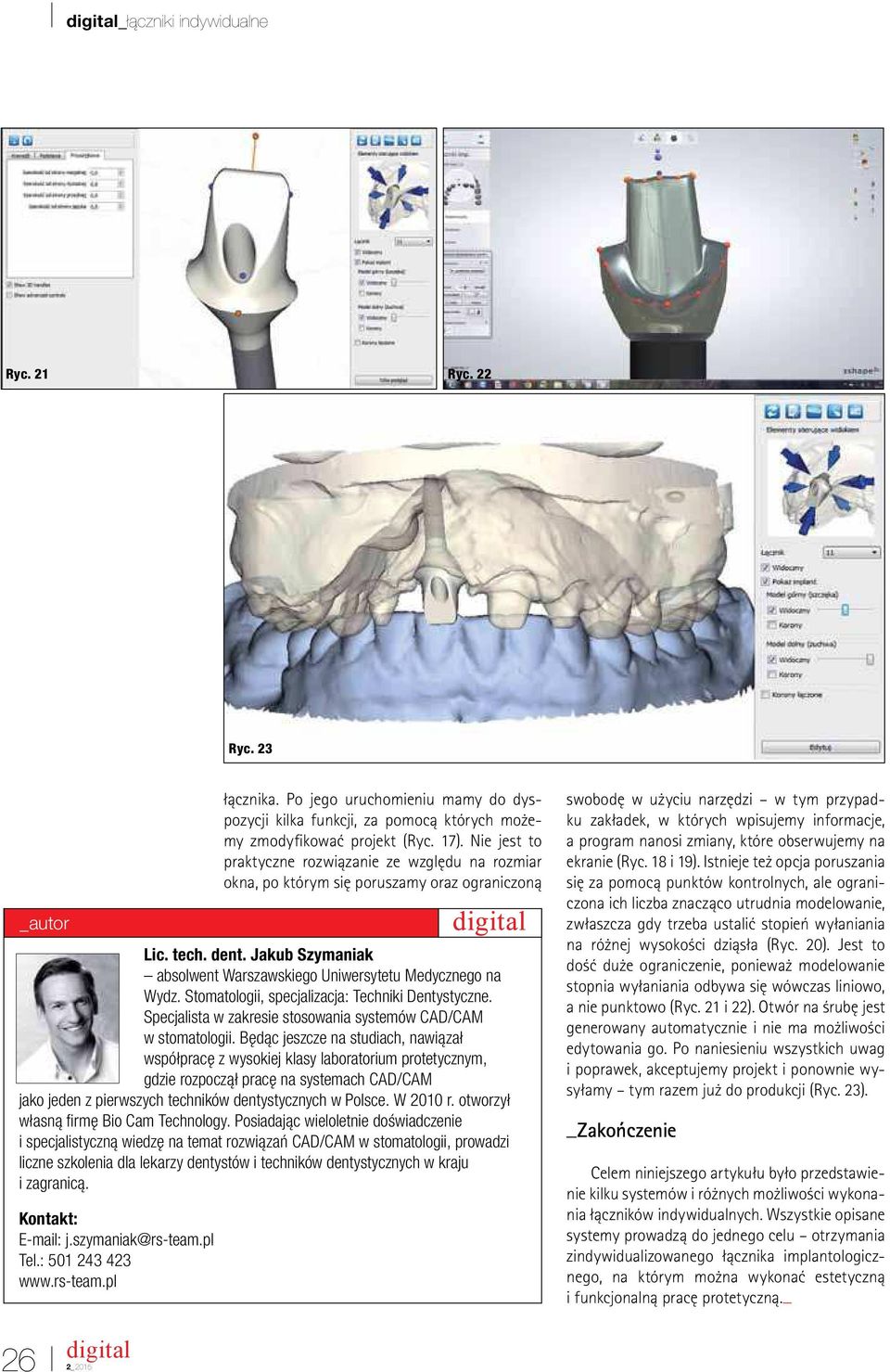 Będąc jeszcze na studiach, nawiązał wsp łpracę z wysokiej klasy laboratorium protetycznym, gdzie rozpoczął pracę na systemach CAD/CAM jako jeden z pierwszych technik w dentystycznych w Polsce.