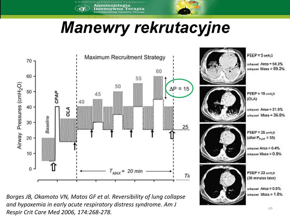 Reversibility of lung collapse and hypoxemia in