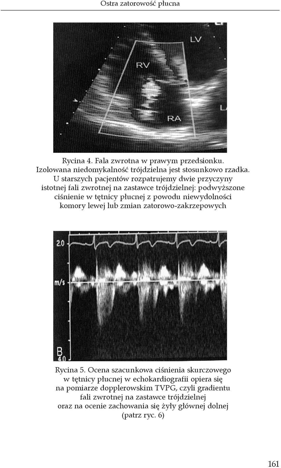 niewydolności komory lewej lub zmian zatorowo-zakrzepowych Rycina 5.