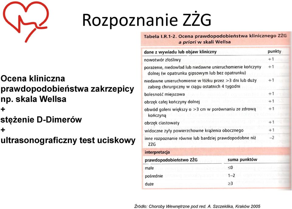 skala Wellsa + stężenie D-Dimerów +