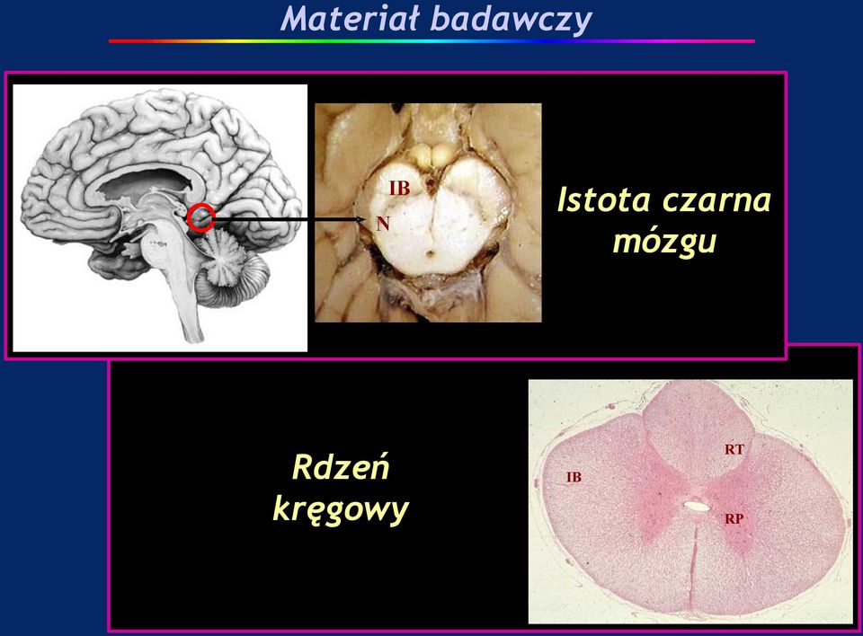 Rdzeń kręgowy