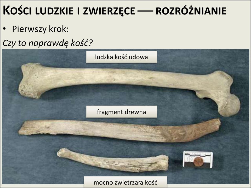 ludzka kośd udowa