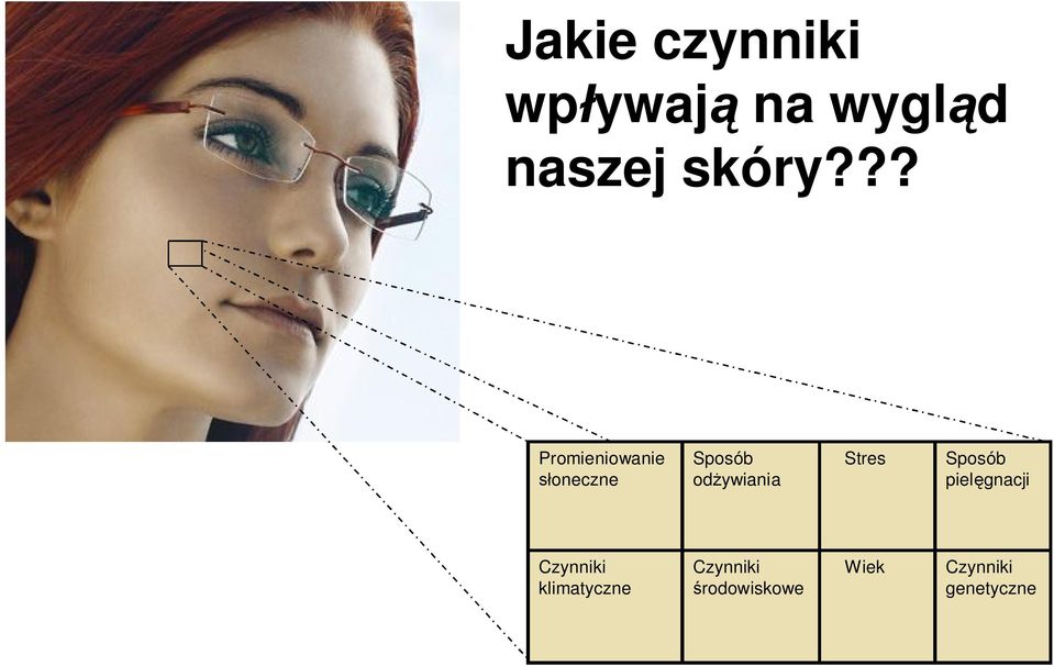 Stres Sposób pielęgnacji Czynniki klimatyczne