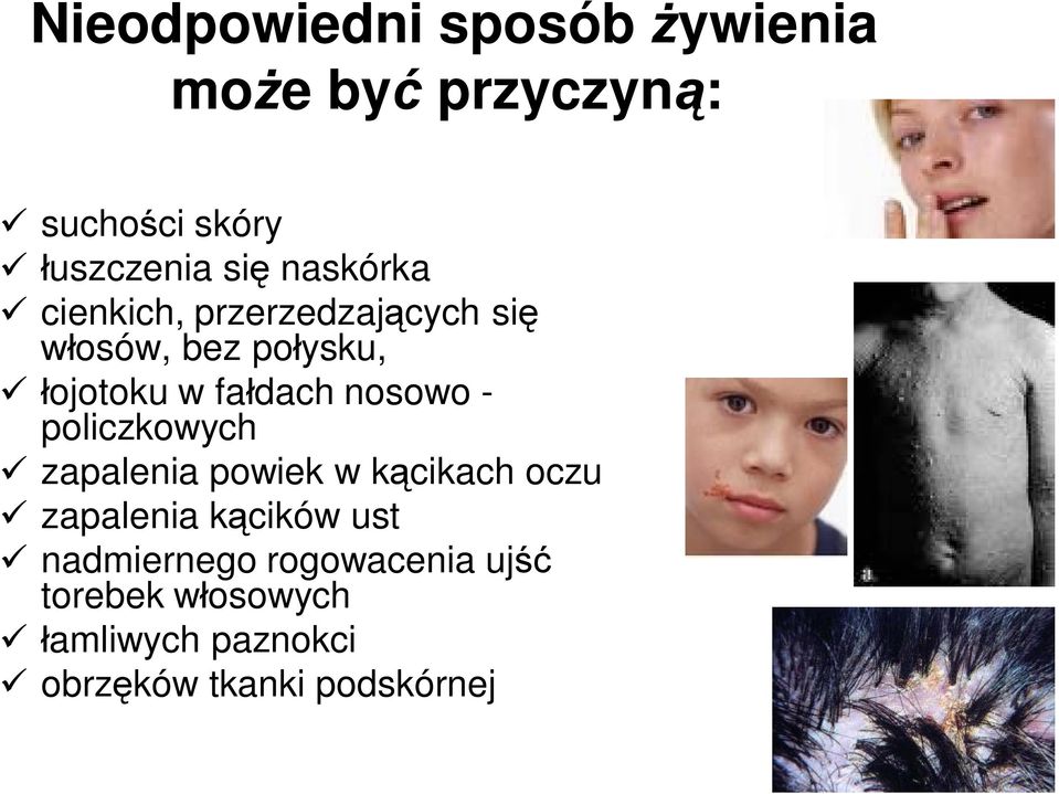 nosowo - policzkowych ü zapalenia powiek w kącikach oczu ü zapalenia kącików ust ü