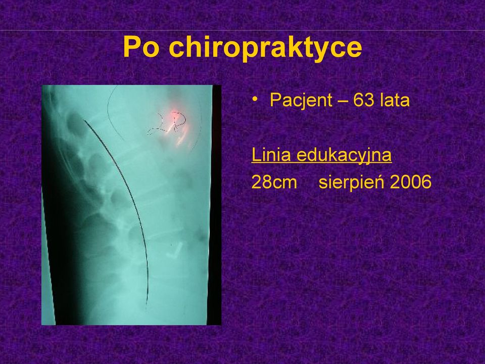 Linia edukacyjna