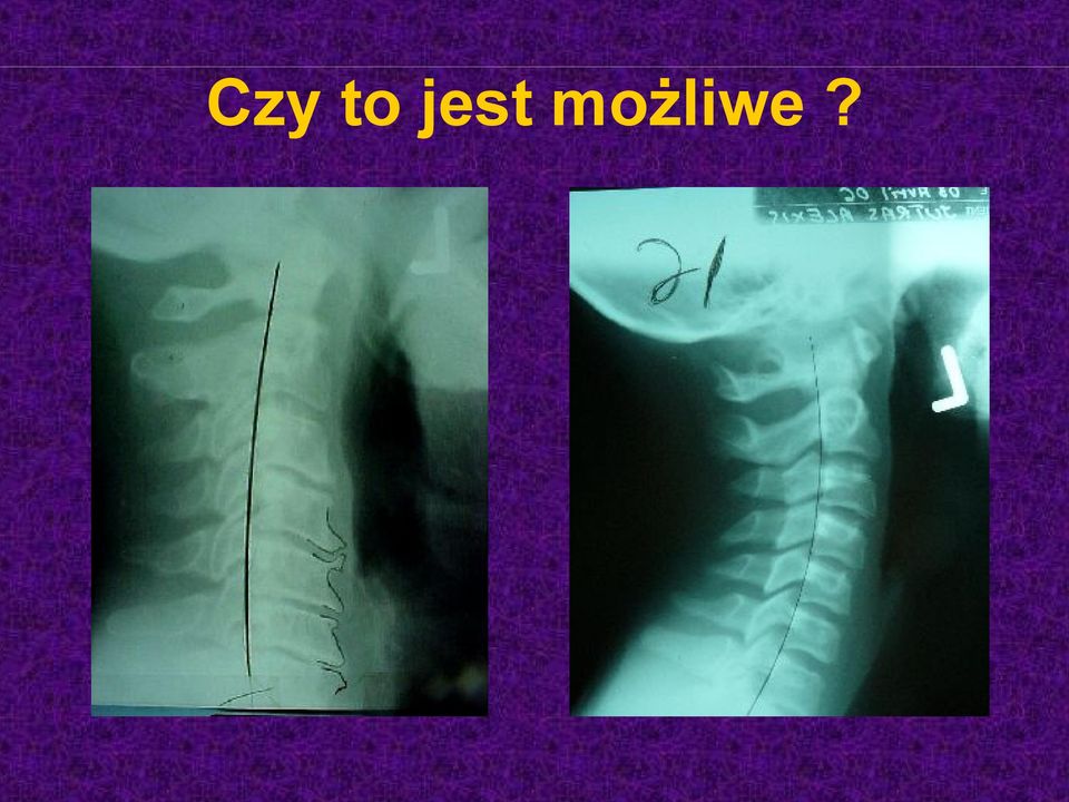możliwe?