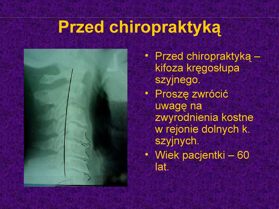 Proszę zwrócić uwagę na zwyrodnienia