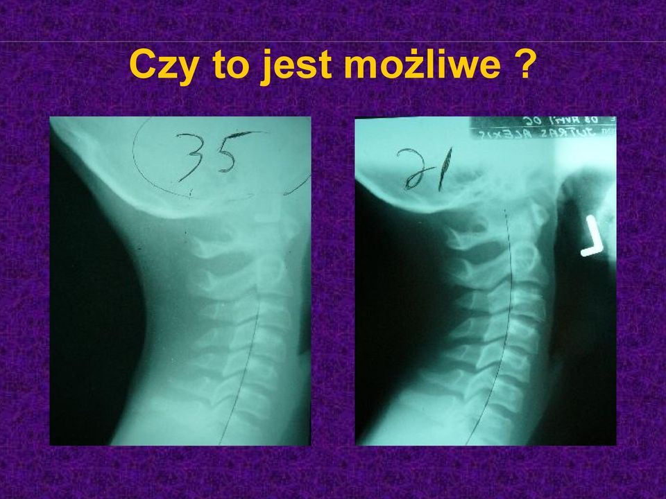 możliwe?
