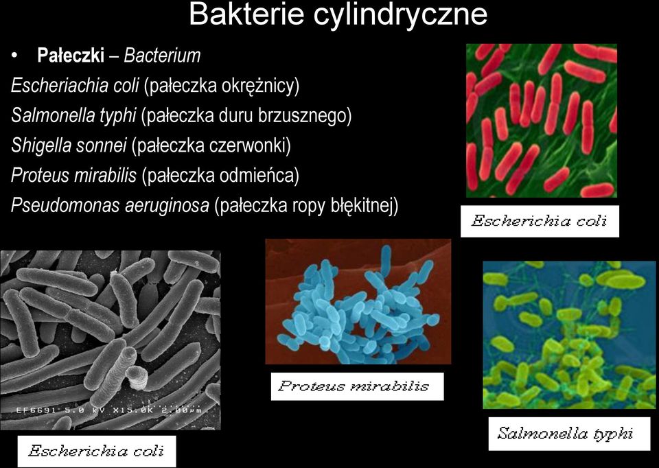 brzusznego) Shigella sonnei (pałeczka czerwonki) Proteus