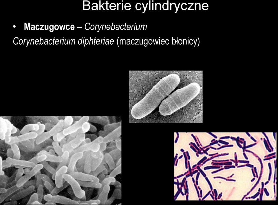 Corynebacterium