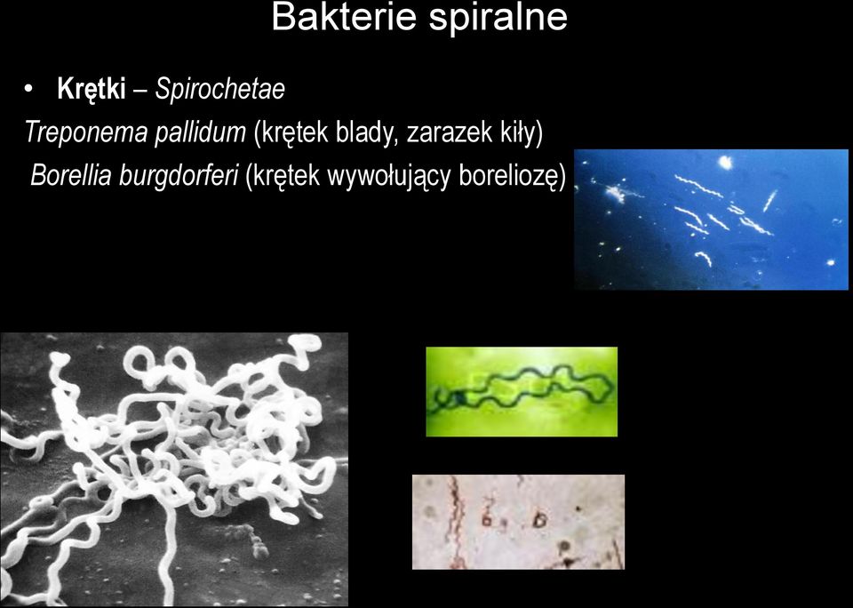 (krętek blady, zarazek kiły)