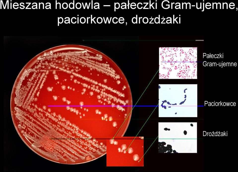 drożdżaki Pałeczki