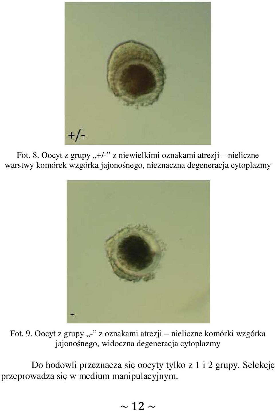 jajonośnego, nieznaczna degeneracja cytoplazmy Fot. 9.