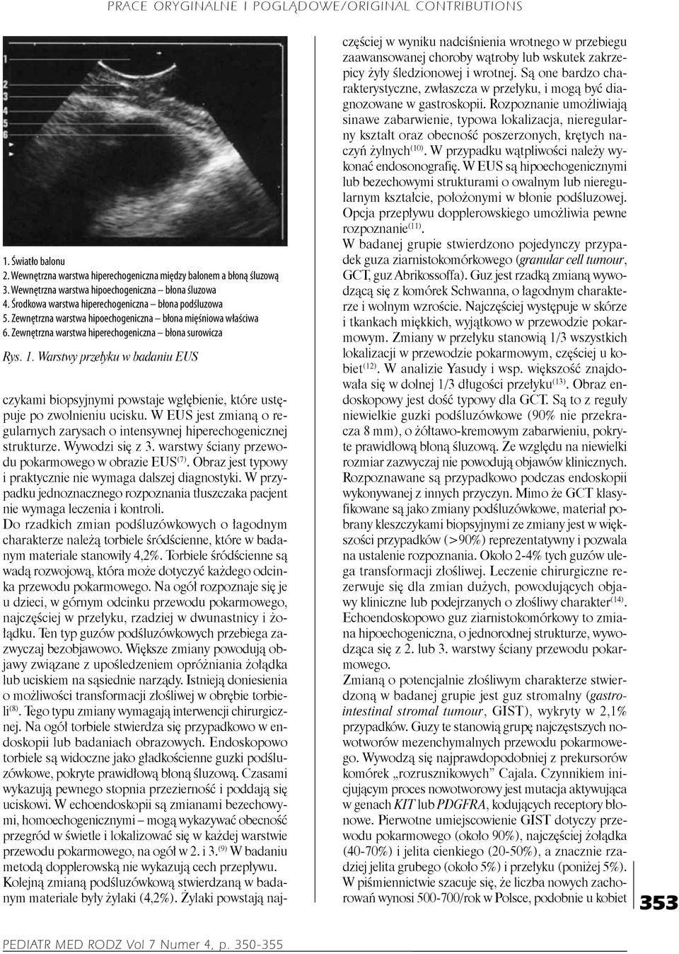 Warstwy przełyku w badaniu EUS czykami biopsyjnymi powstaje wgłębienie, które ustępuje po zwolnieniu ucisku. W EUS jest zmianą o regularnych zarysach o intensywnej hiperechogenicznej strukturze.