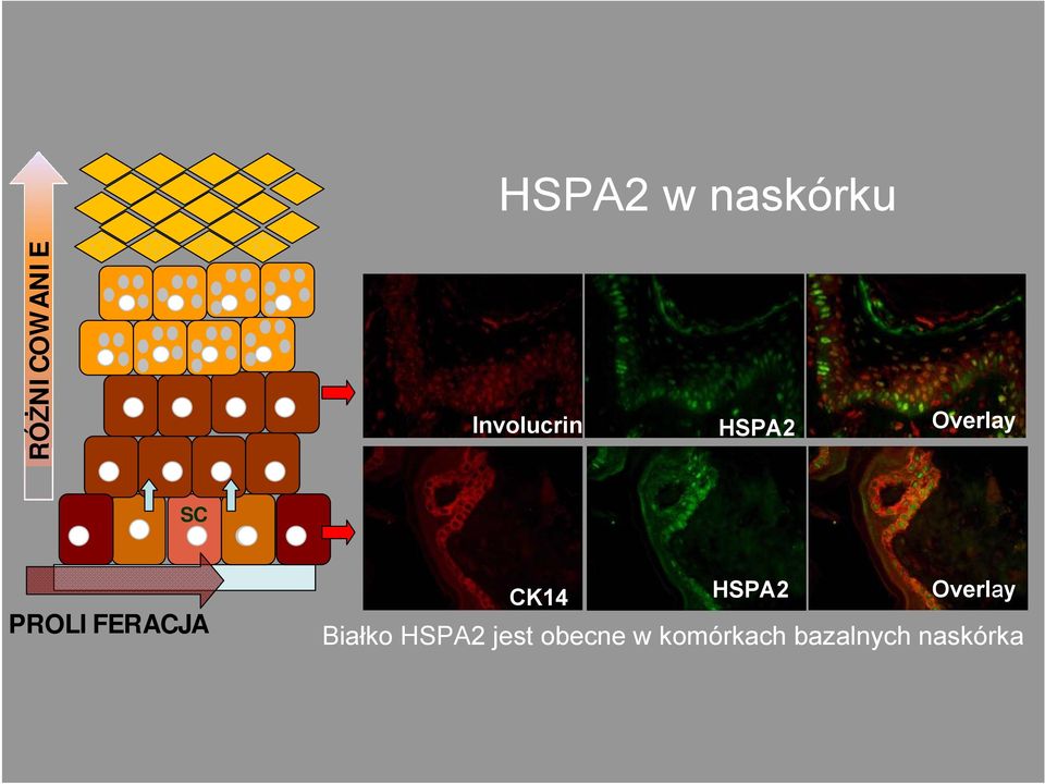 PROLIFERACJA CK14 HSPA2 Overlay