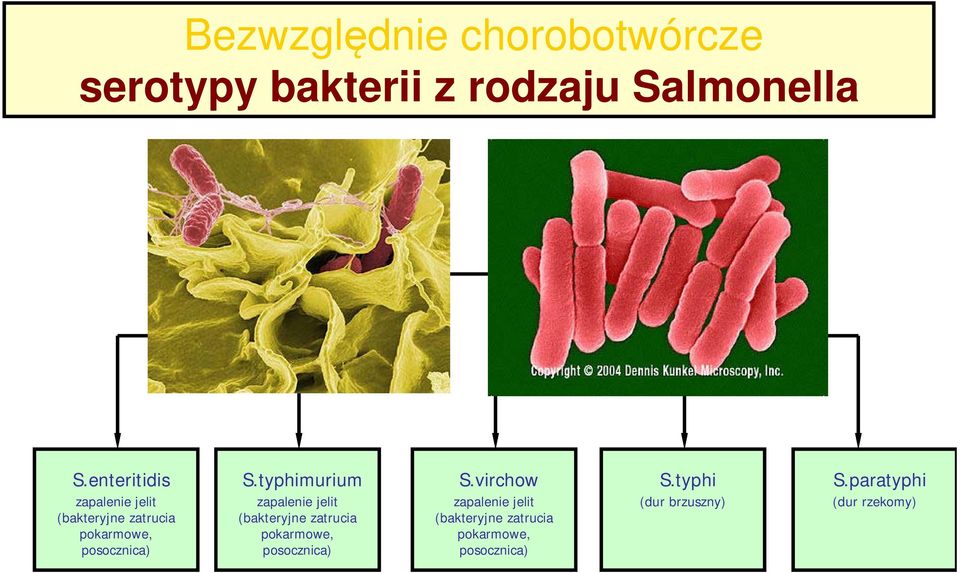 typhimurium zapalenie jelit (bakteryjne zatrucia pokarmowe, posocznica) S.