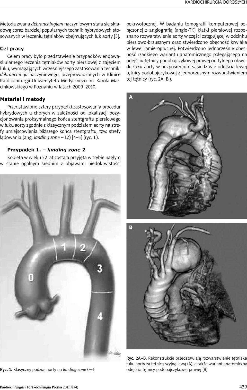 przeprowadzonych w Klinice Kardiochirurgii Uniwersytetu Medycznego im. Karola Marcinkowskiego w Poznaniu w latach 2009 2010.