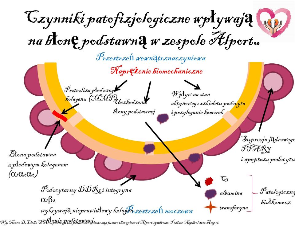 Podocytarny DDR1 i integryna α1β2 wykrywają nieprawidłowy kolagen w błonie podstawnej Przestrzeń moczowa Wg: Noone D, Licht C.