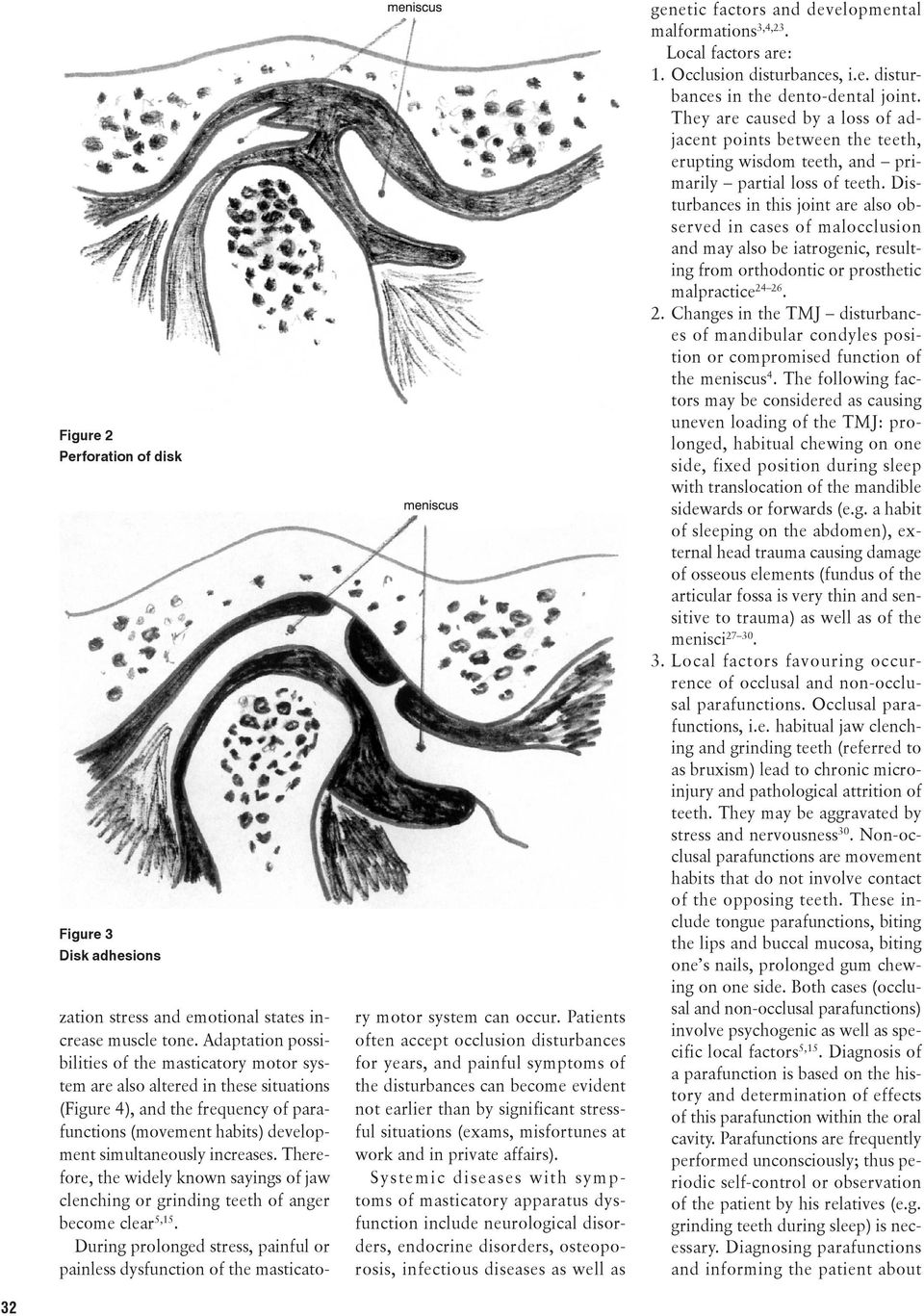 Therefore, the widely known sayings of jaw clenching or grinding teeth of anger become clear 5,15. During prolonged stress, painful or painless dysfunction of the masticatory motor system can occur.