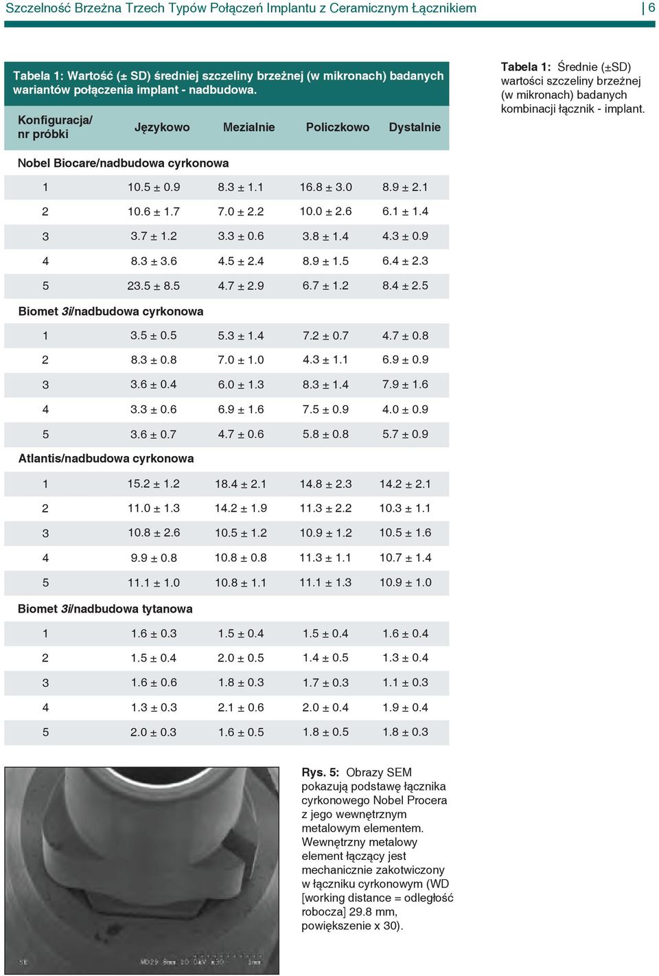 Nobel Biocare/nadbudowa cyrkonowa 1 10.5 ± 0.9 8.3 ± 1.1 16.8 ± 3.0 8.9 ± 2.1 2 10.6 ± 1.7 7.0 ± 2.2 10.0 ± 2.6 6.1 ± 1.4 3 3.7 ± 1.2 3.3 ± 0.6 3.8 ± 1.4 4.3 ± 0.9 4 8.3 ± 3.6 4.5 ± 2.4 8.9 ± 1.5 6.