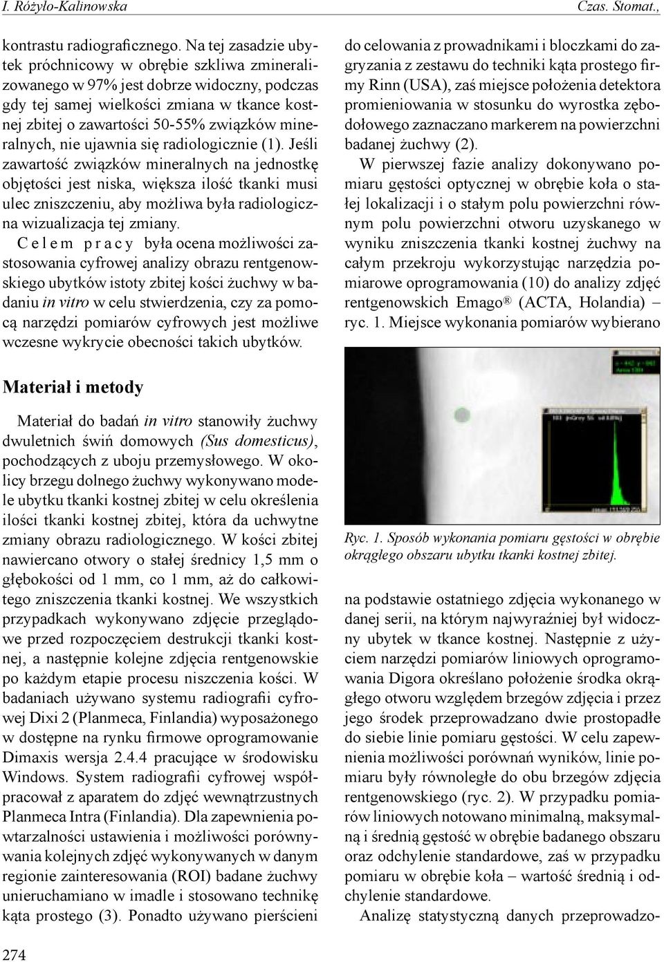 mineralnych, nie ujawnia się radiologicznie (1).