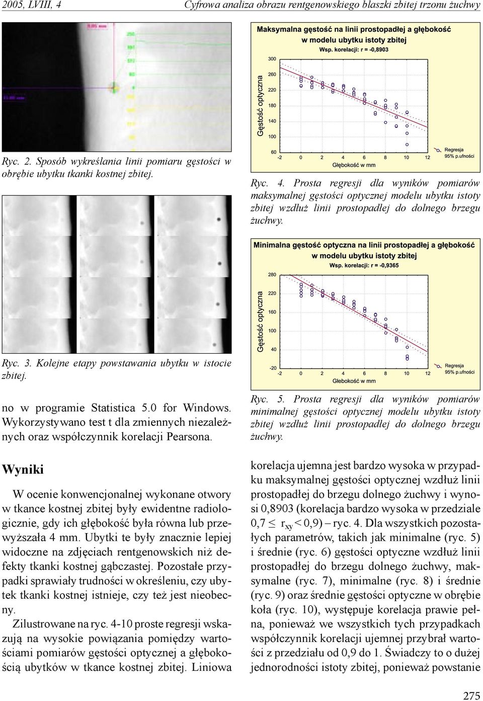 Wyniki W ocenie konwencjonalnej wykonane otwory w tkance kostnej zbitej były ewidentne radiologicznie, gdy ich głębokość była równa lub przewyższała 4 mm.