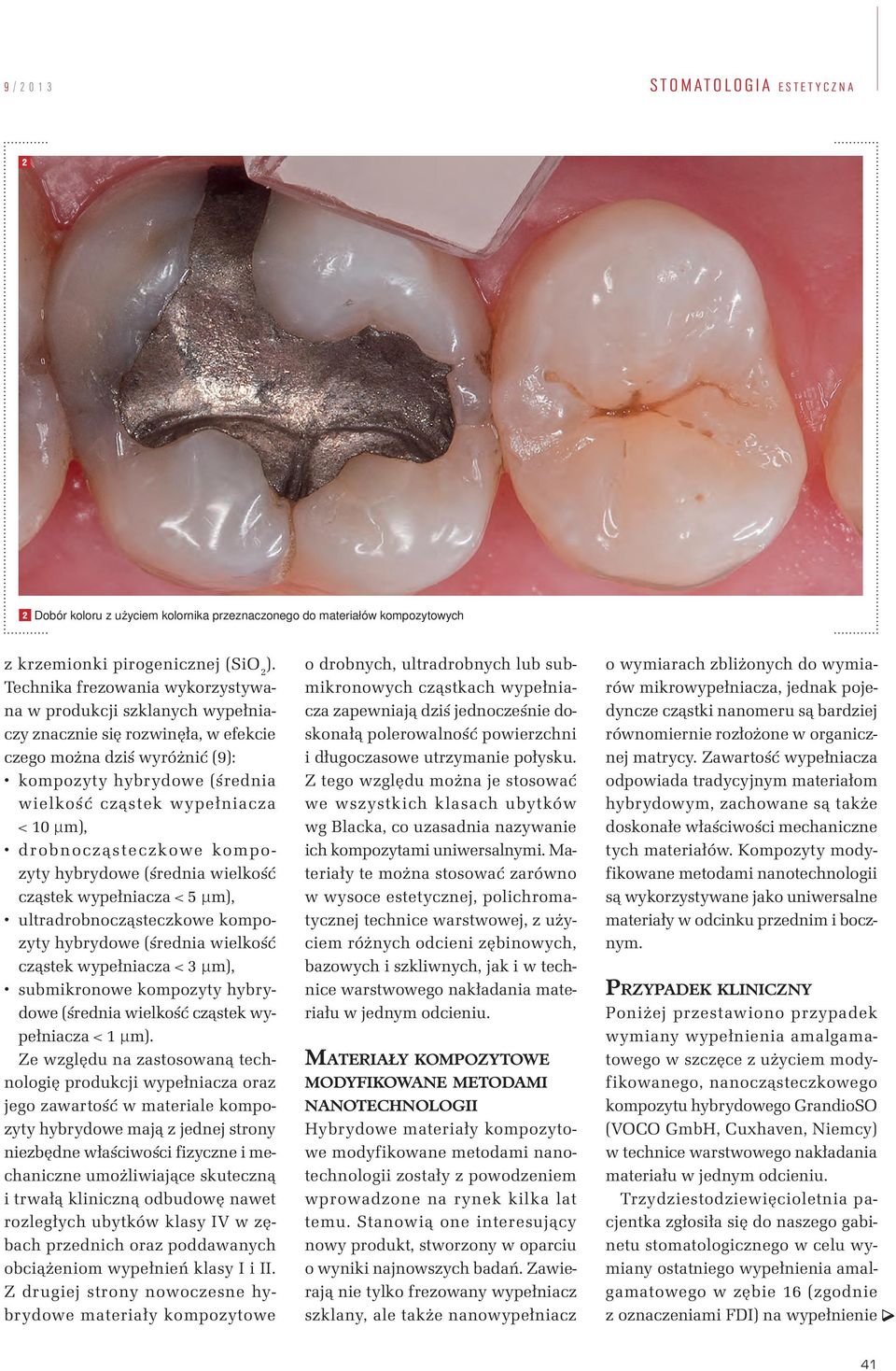 µm), drobnocząsteczkowe kompozyty hybrydowe (średnia wielkość cząstek wypełniacza < 5 µm), ultradrobnocząsteczkowe kompozyty hybrydowe (średnia wielkość cząstek wypełniacza < 3 µm), submikronowe