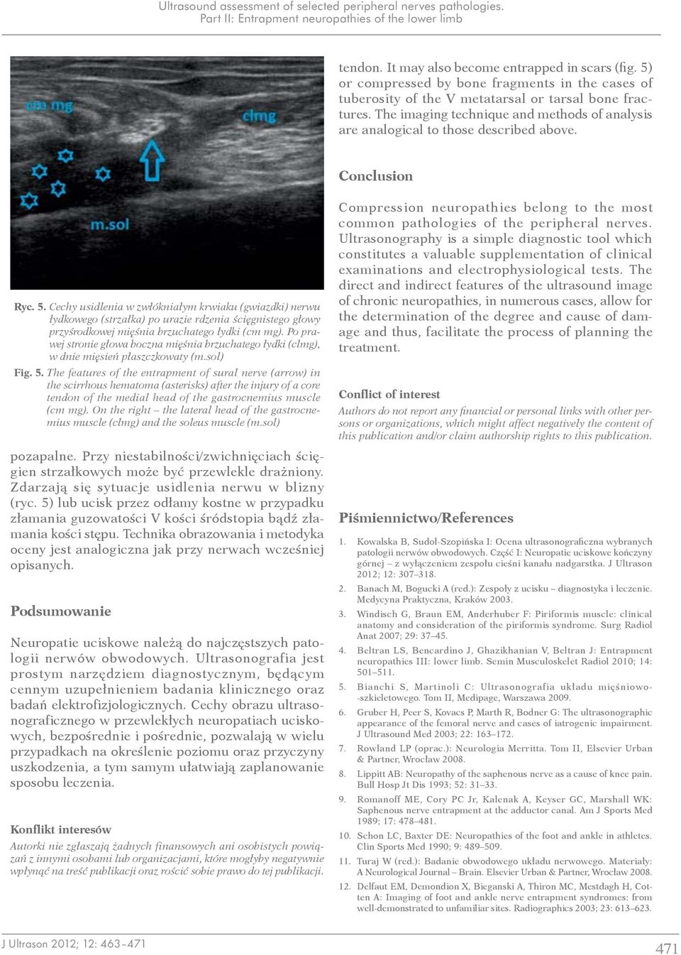 Conclusion Ryc. 5. Cechy usidlenia w zwłókniałym krwiaku (gwiazdki) nerwu łydkowego (strzałka) po urazie rdzenia ścięgnistego głowy przyśrodkowej mięśnia brzuchatego łydki (cm mg).