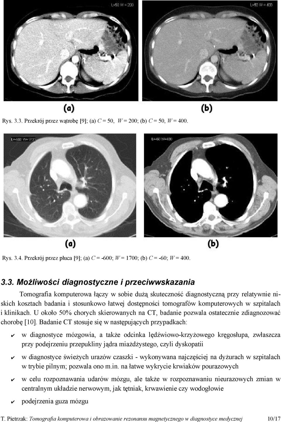 Tomografia komputerowa łączy w sobie dużą skuteczność diagnostyczną przy relatywnie niskich kosztach badania i stosunkowo łatwej dostępności tomografów komputerowych w szpitalach i klinikach.