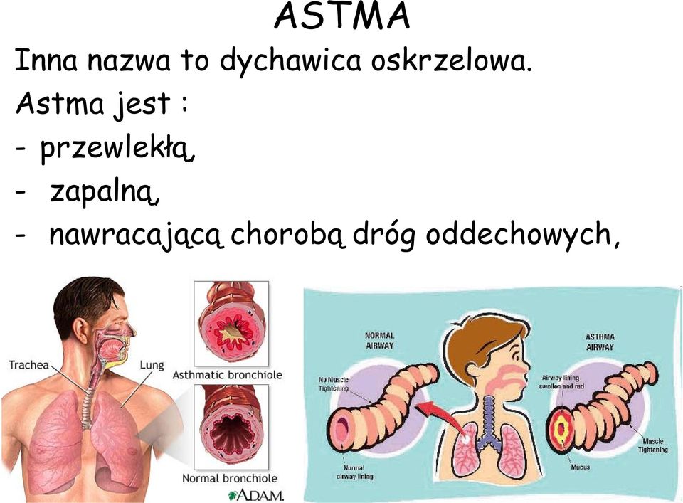 Astma jest : - przewlekłą, -