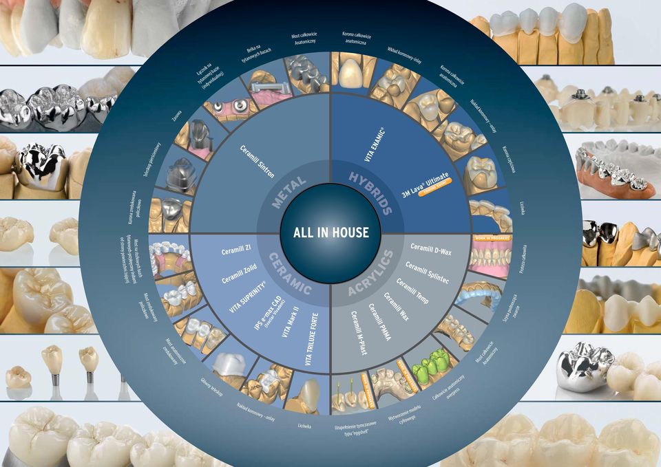 Most Most anatomicznie anatomicznie Ceramill ZI Ceramill Ceramill Sintron Sintron Ceramill Zolid VITA VITA SUPRINITY SUPRINITY T L META META CERAMIC (Ivoclar (Ivoclar Vivadent) Vivadent) IPS e-max