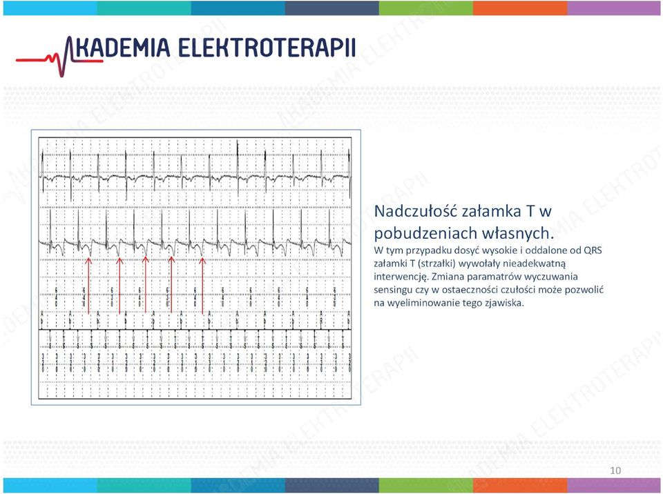 przepony Interferencje pomiędzy elektrodami.