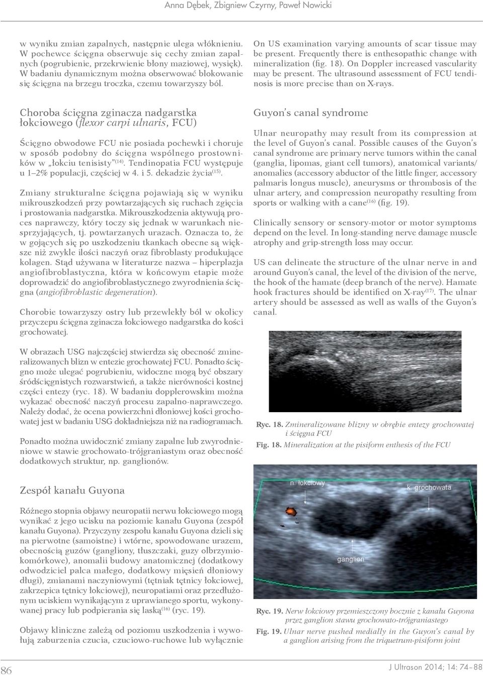 W badaniu dynamicznym można obserwować blokowanie się ścięgna na brzegu troczka, czemu towarzyszy ból. On US examination varying amounts of scar tissue may be present.