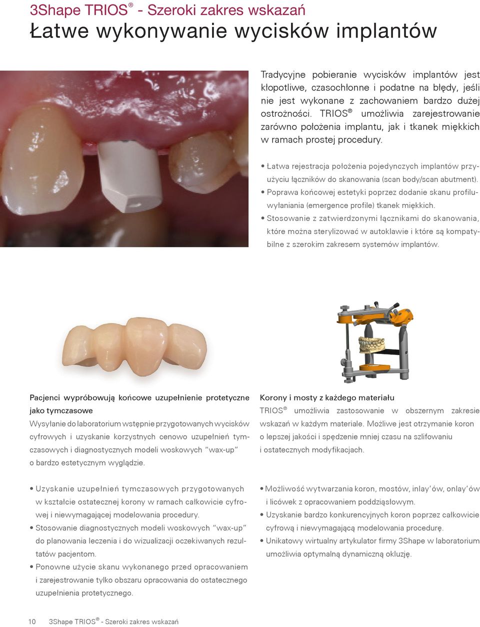 Łatwa rejestracja położenia pojedynczych implantów przy - użyciu łączników do skanowania (scan body/scan abutment).