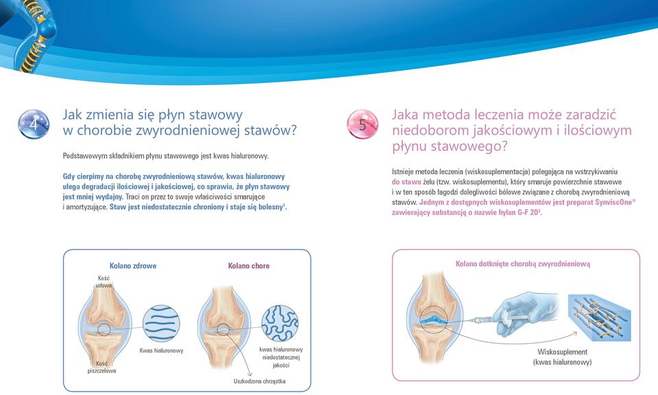 Traci on przez to swoje właściwości smarujące i amortyzujące. Staw jest niedostatecznie chroniony i staje się bolesny 1.