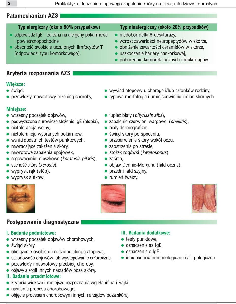 Typ niealergiczny (oko o 20% przypadków) niedobór delta 6-desaturazy, wzrost zawartoêci neuropeptydów w skórze, obni enie zawartoêci ceramidów w skórze, uszkodzenie bariery naskórkowej, pobudzenie