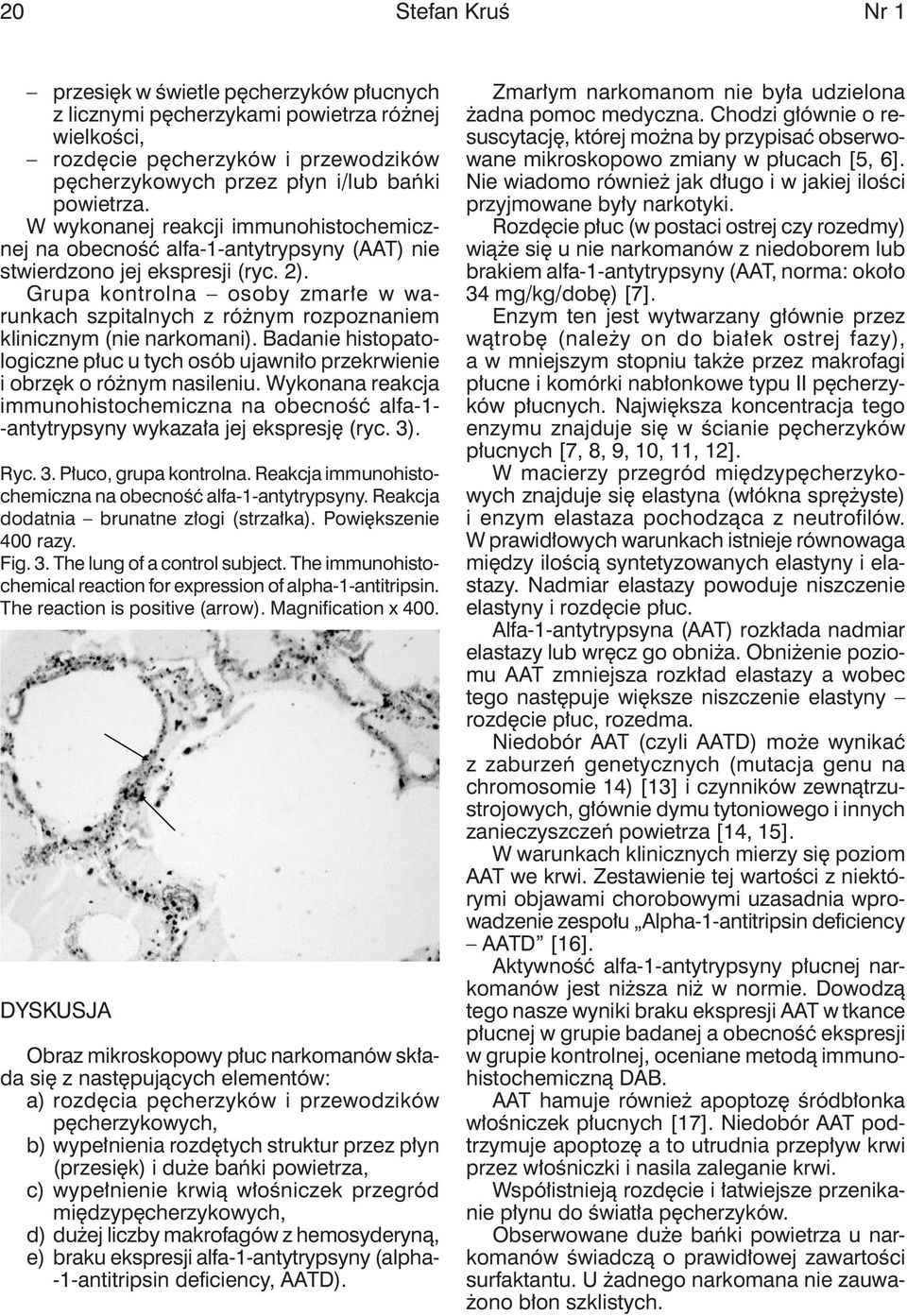 Grupa kontrolna osoby zmarłe w warunkach szpitalnych z różnym rozpoznaniem klinicznym (nie narkomani). Badanie histopatologiczne płuc u tych osób ujawniło przekrwienie i obrzęk o różnym nasileniu.