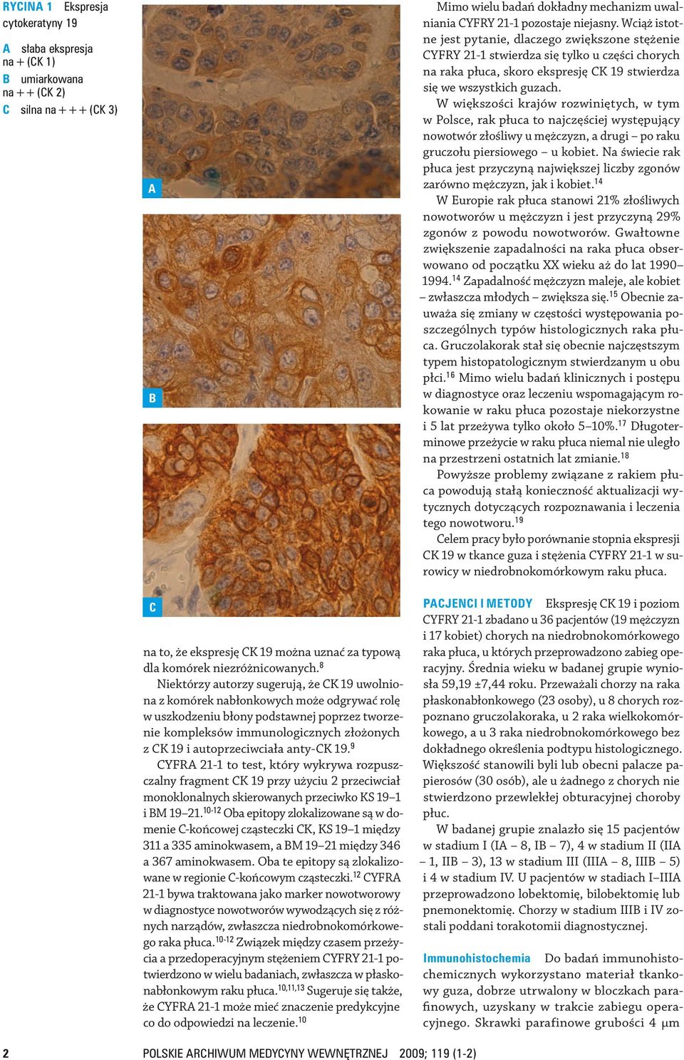 przeciwciała anty CK 19. 9 CYFRA 21-1 to test, który wykrywa rozpuszczalny fragment CK 19 przy użyciu 2 przeciw ciał monoklonalnych skierowanych przeciw ko KS 19 1 i BM 19 21.