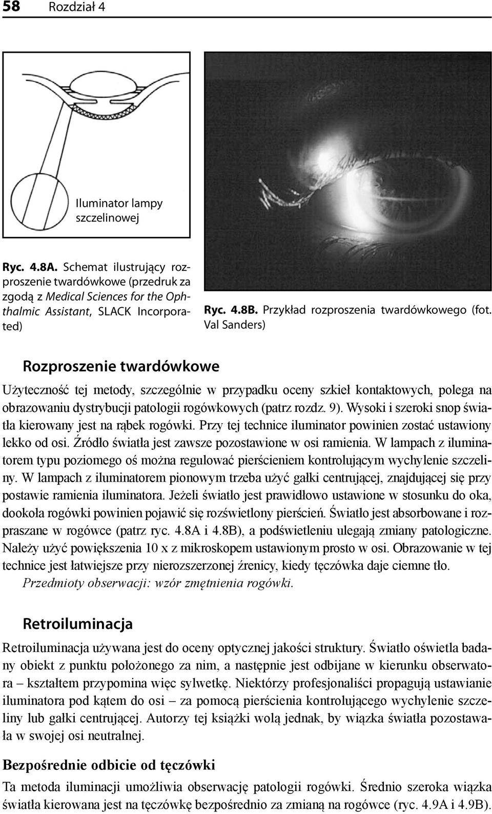 Val Sanders) Rozproszenie twardówkowe Użyteczność tej metody, szczególnie w przypadku oceny szkieł kontaktowych, polega na obrazowaniu dystrybucji patologii rogówkowych (patrz rozdz. 9).