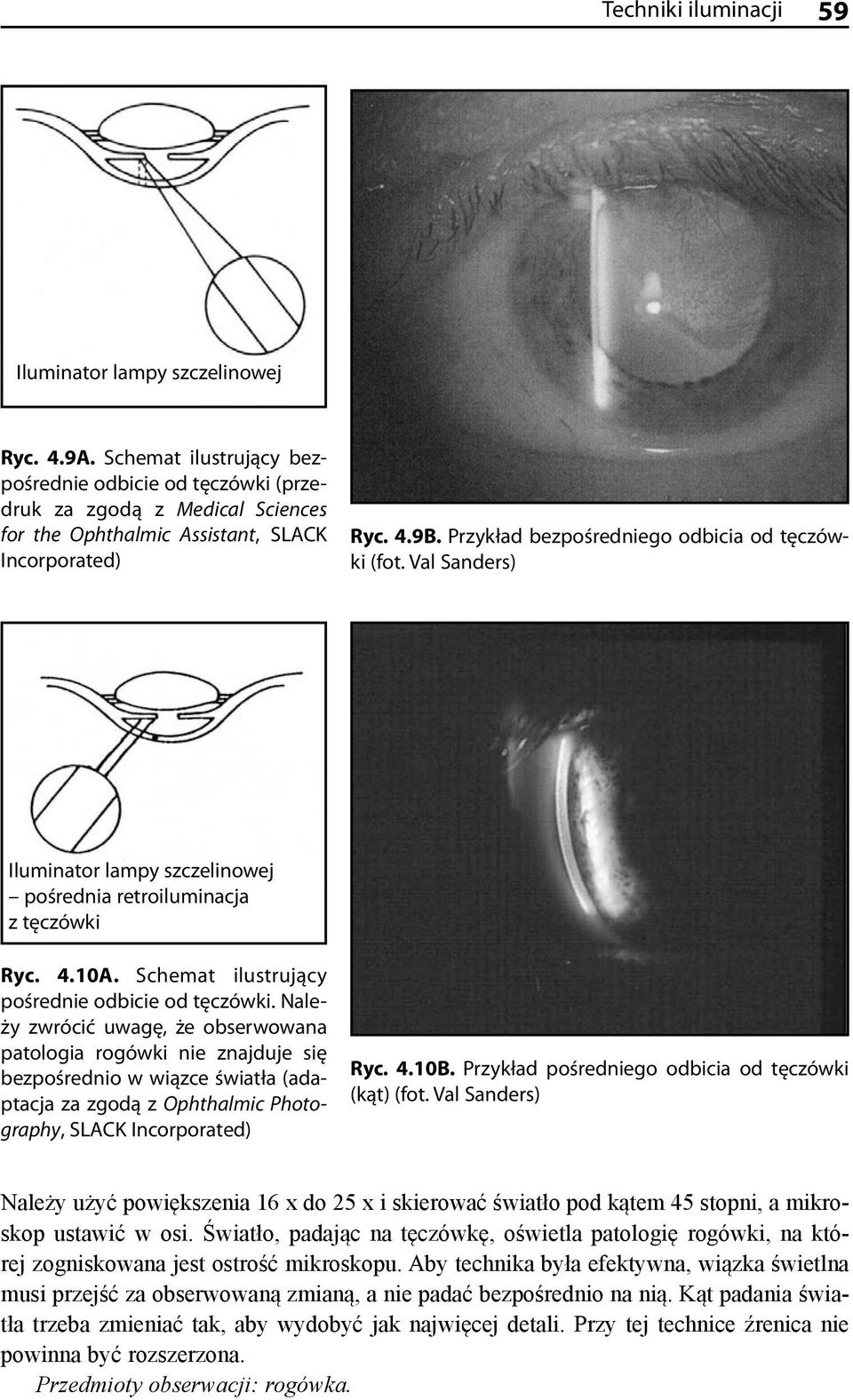 Przykład bezpośredniego odbicia od tęczówki (fot. Val Sanders) Iluminator lampy szczelinowej pośrednia retroiluminacja z tęczówki Ryc. 4.10A. Schemat ilustrujący pośrednie odbicie od tęczówki.
