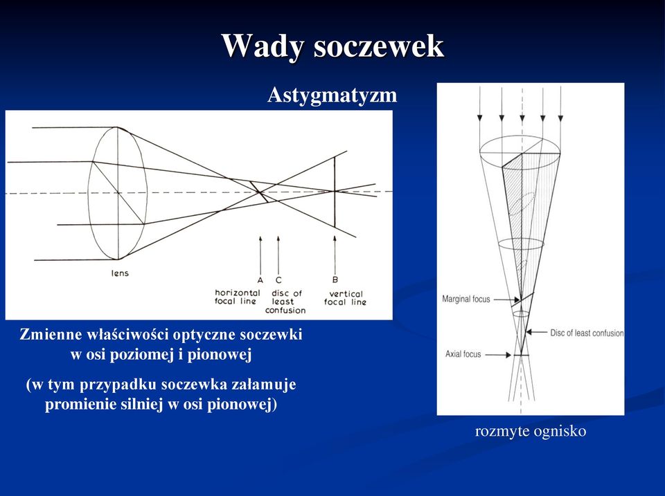 poziomej i pionowej (w tym przypadku