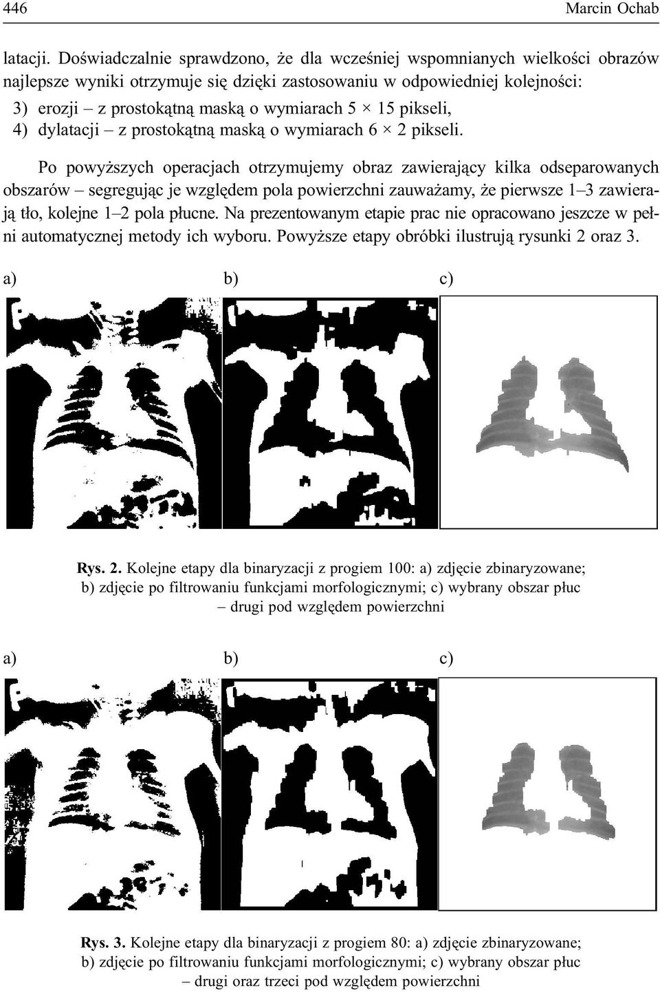 pikseli, 4) dylatacji z prostok¹tn¹ mask¹ o wymiarach 6 2 pikseli.