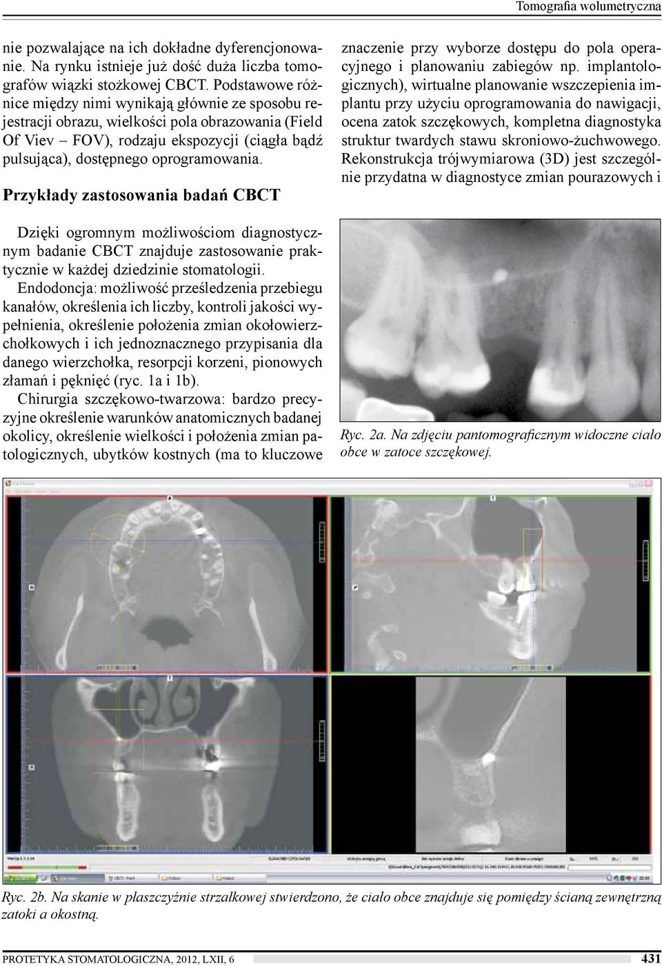Przykłady zastosowania badań CBCT Dzięki ogromnym możliwościom diagnostycznym badanie CBCT znajduje zastosowanie praktycznie w każdej dziedzinie stomatologii.