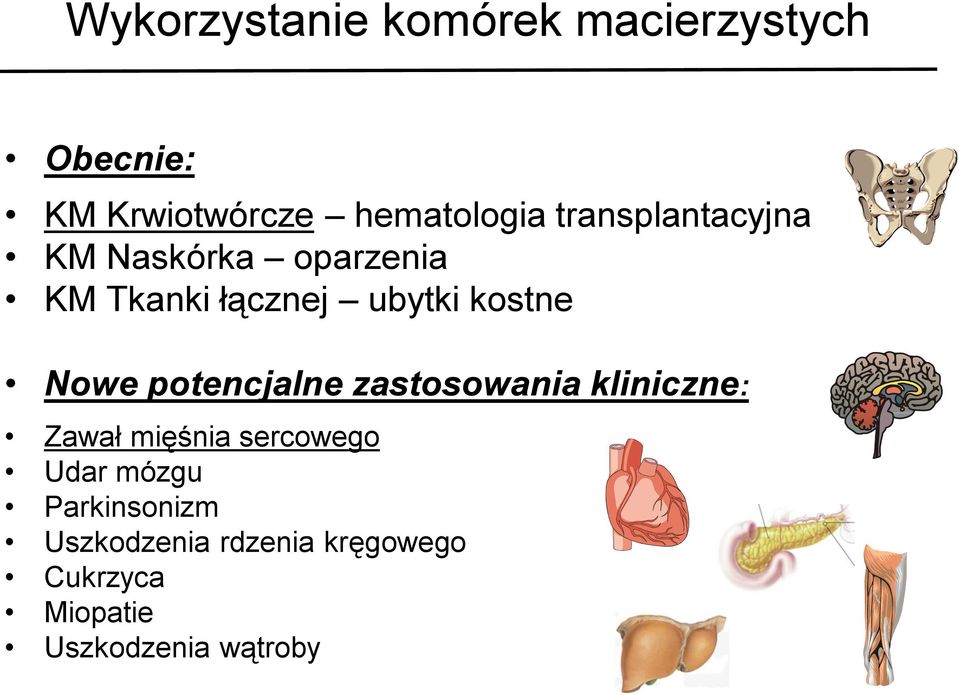 Nowe potencjalne zastosowania kliniczne: Zawał mięśnia sercowego Udar