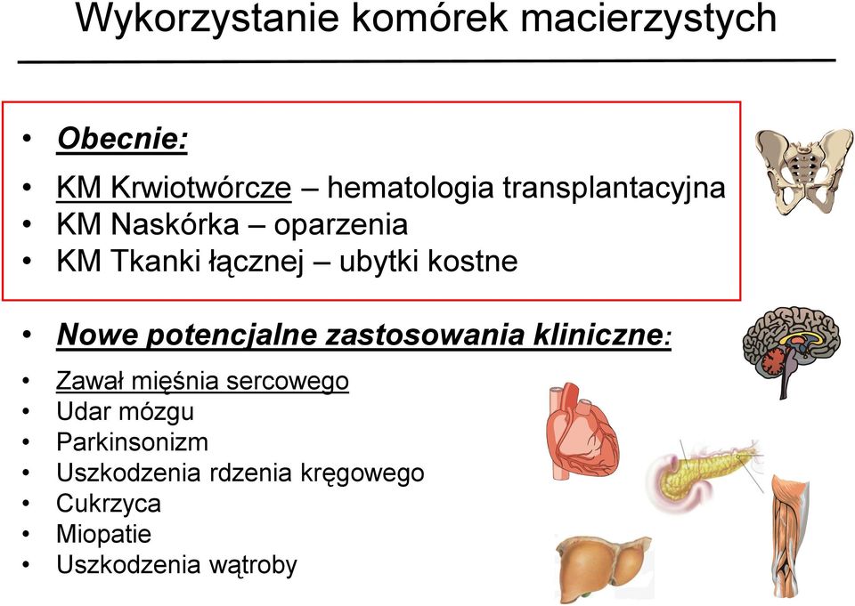 Nowe potencjalne zastosowania kliniczne: Zawał mięśnia sercowego Udar