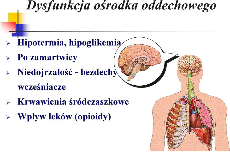 Niedojrzałość - bezdechy wcześniacze