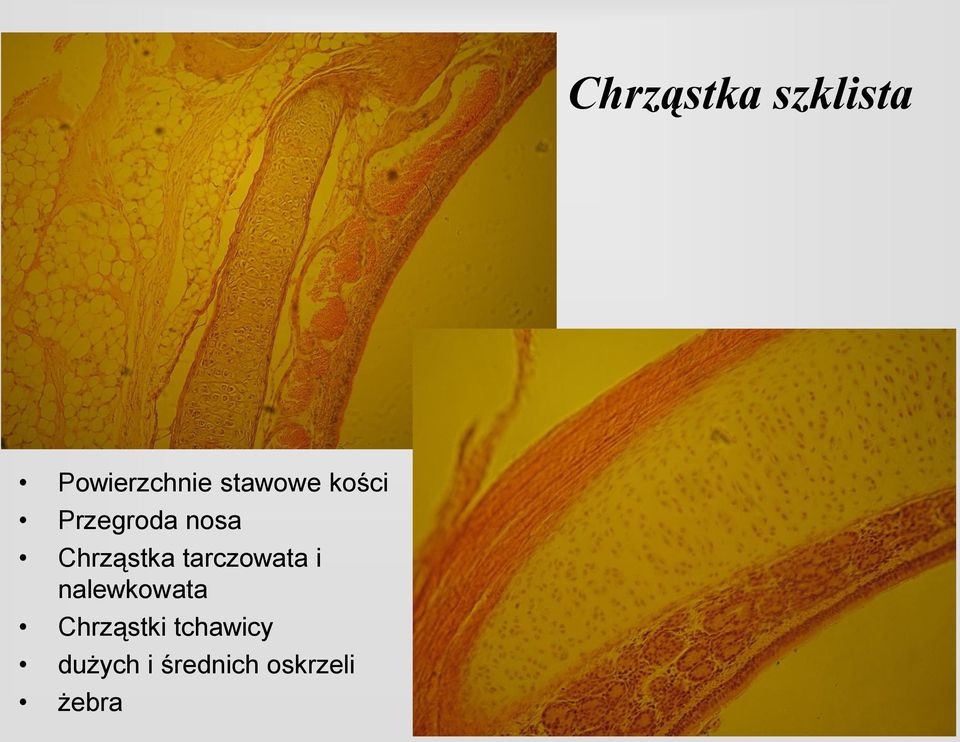 Chrząstka tarczowata i nalewkowata